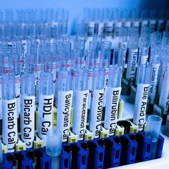 Zabeležen prvi slučaj majmunskih boginja u UAE